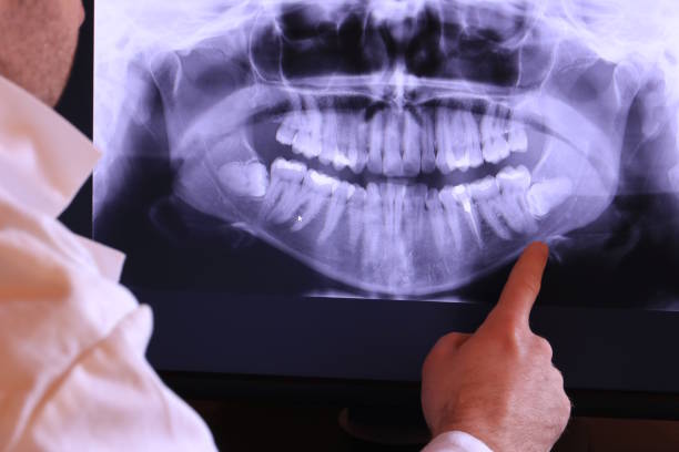 Best Emergency Dentist for Knocked-Out Tooth in Newport, VT