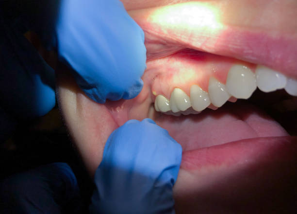 Best Emergency Cosmetic Dentistry in Newport, VT