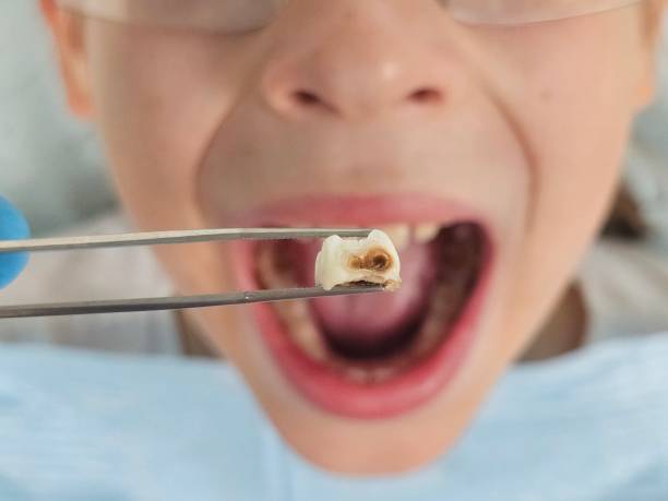 Best Mobile Emergency Dentist in Newport, VT