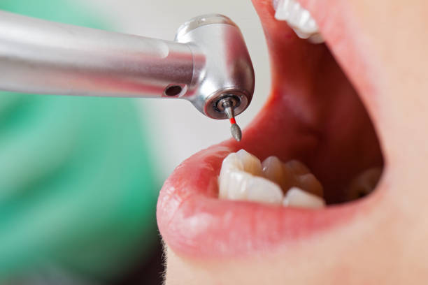 Best Orthodontic Emergency Dentist in Newport, VT